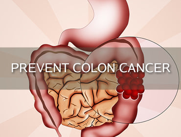 Top 12 Steps You Can Take to Prevent Colon Cancer Today!