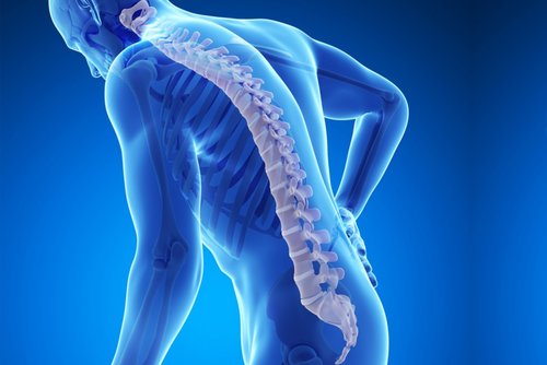 Natural Osteoporosis Therapy